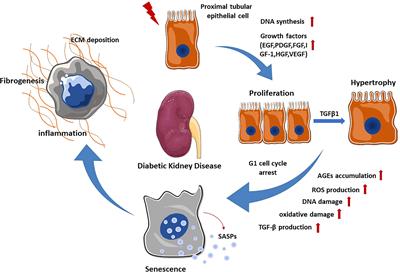 Tubular injury in diabetic kidney disease: molecular mechanisms and potential therapeutic perspectives